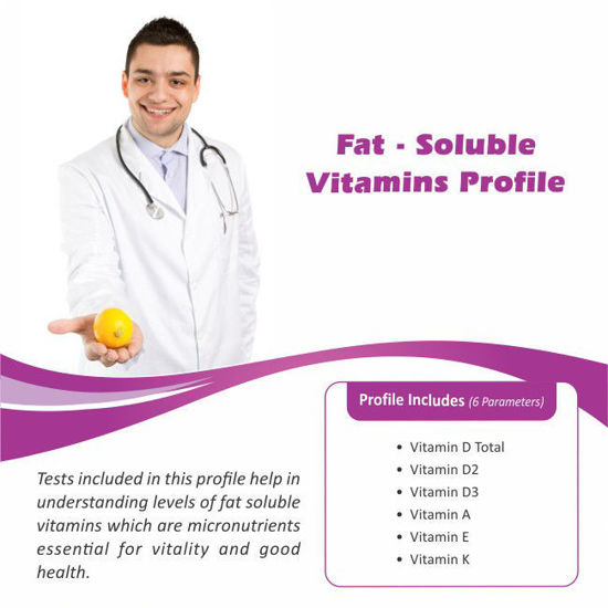 Thyrocare FAT SOLUBLE VITAMINS PROFILE bellary