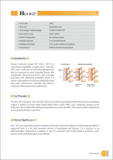 Thyrocare HLA B27 akola