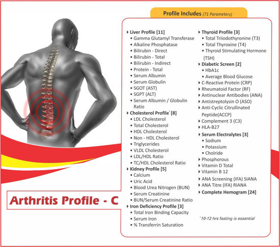 ARTHRITIS PROFILE C