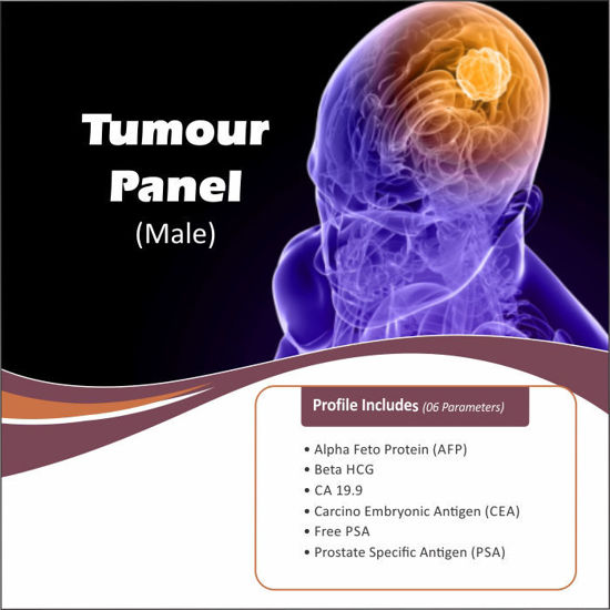 Thyrocare JAANCH TUMOUR PANEL (MALE) calcutta