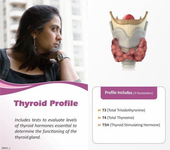 Thyrocare Thyroid Function Test (TFT) hyderabad